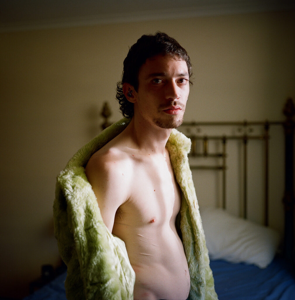 Liam gazes towards the camera, his fur coat slipping off his shoulder to reveal a torso patterned with scars. He’s been crying.